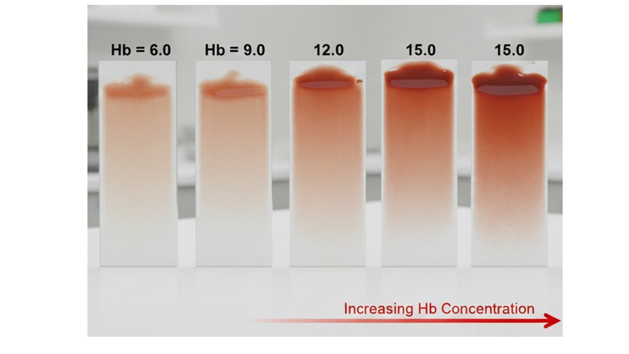 Hemoglobin Measurement